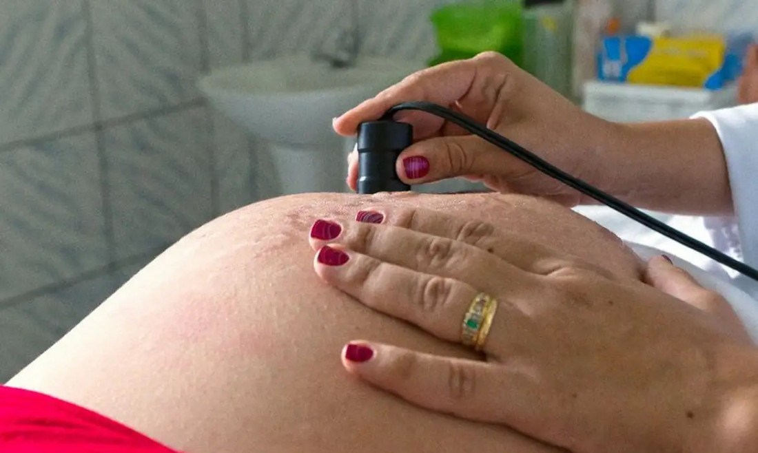 Justiça dá prazo de 72 horas para CFM explicar proibição de pré-aborto