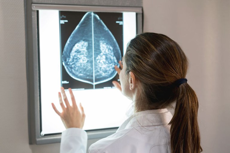 SUS amplia acesso à mamografia a mulheres de 40 a 49 anos
