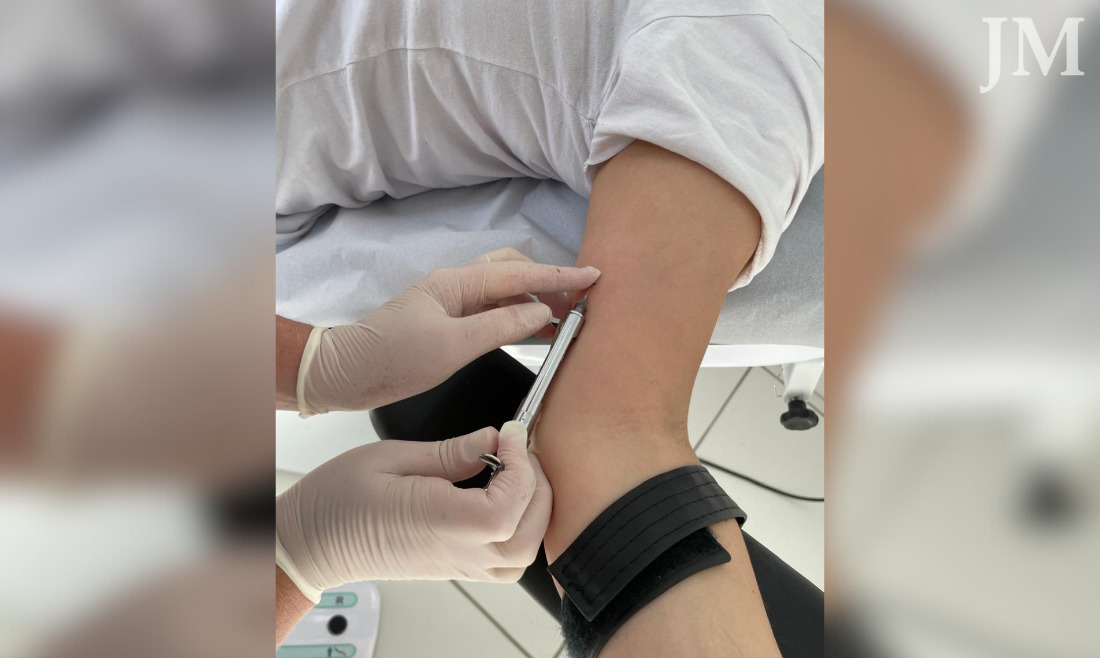 O contraceptivo é seguro, discreto e de longa duração