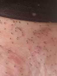 Mosquito ataca a qualquer hora do dia