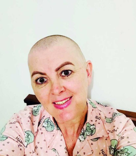 A perda do cabelo foi um momento dif&iacute;cil